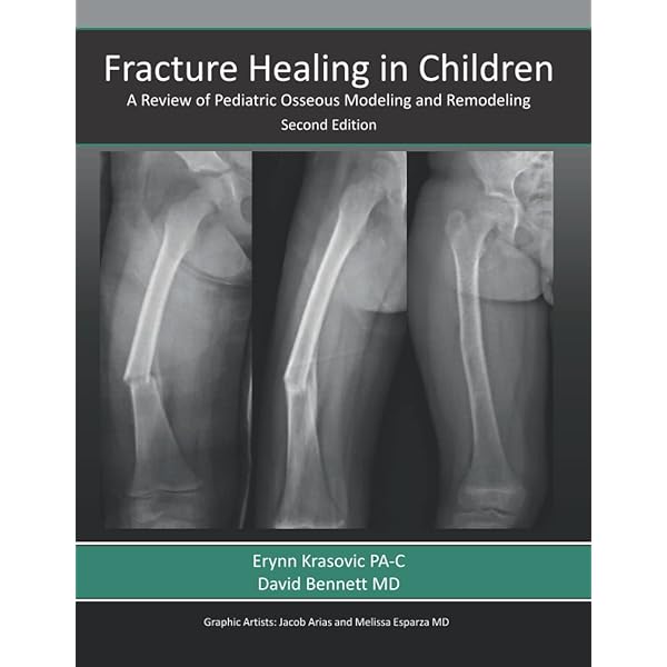 Rockwood and Wilkins' Fractures in Children: Print + eBook with